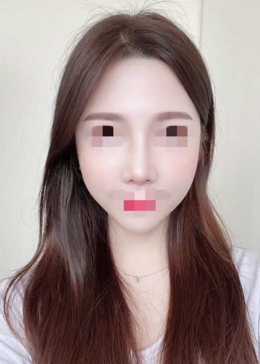 수술후기이미지