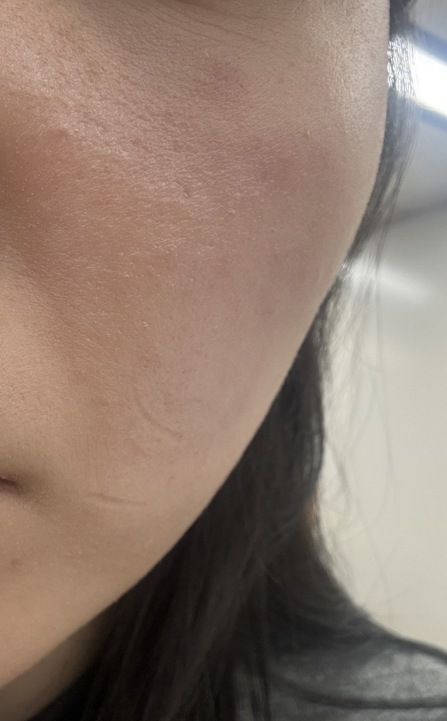 수술후기이미지