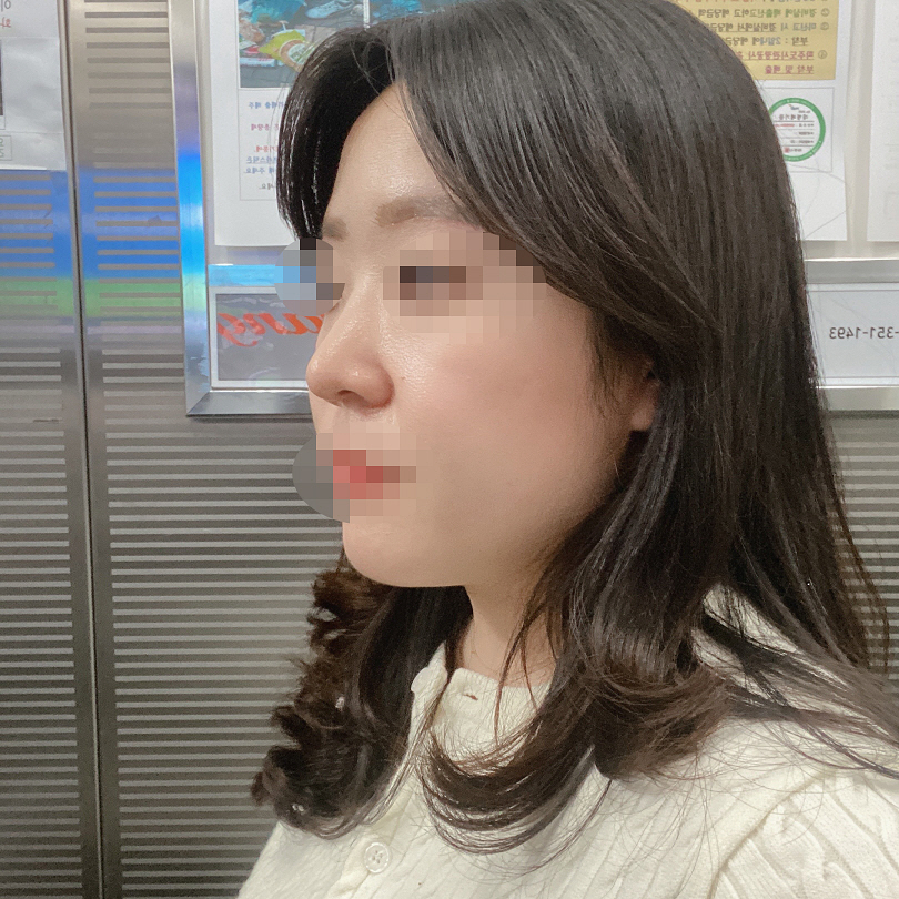 수술후기이미지