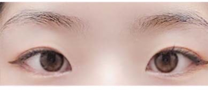 수술후기이미지