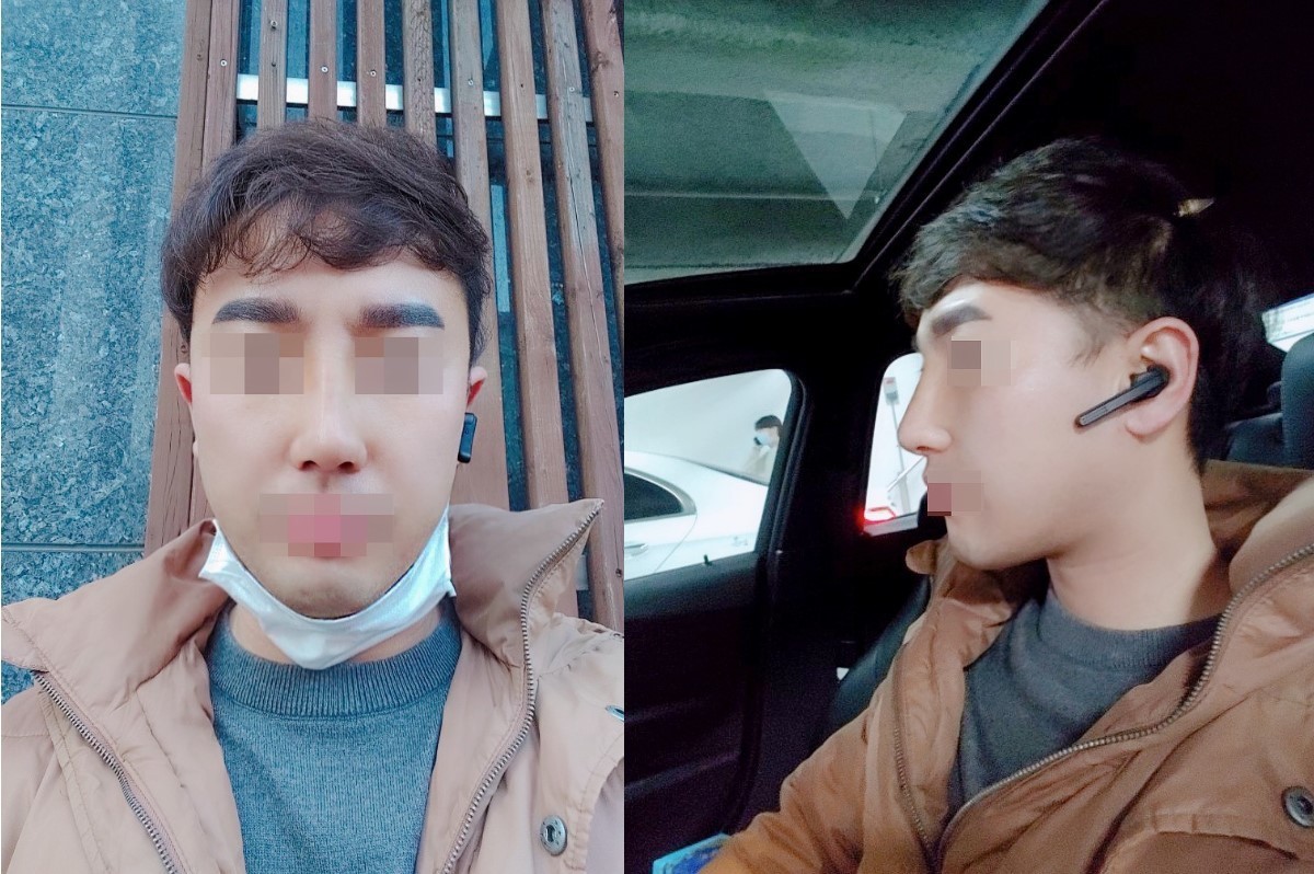 수술후기이미지