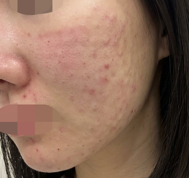 수술후기이미지