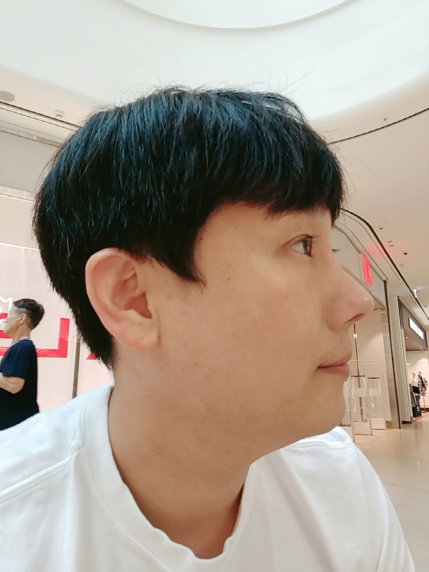 수술후기이미지