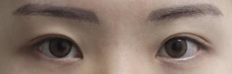 수술후기이미지