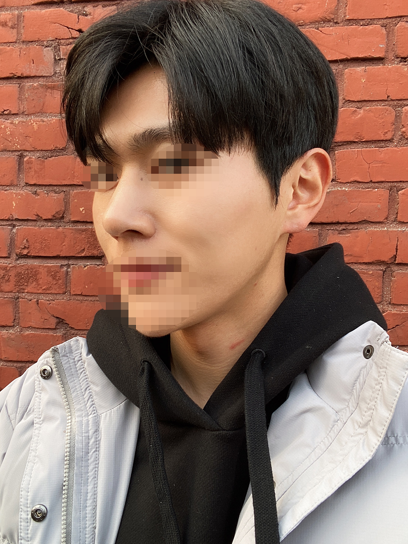 수술후기이미지