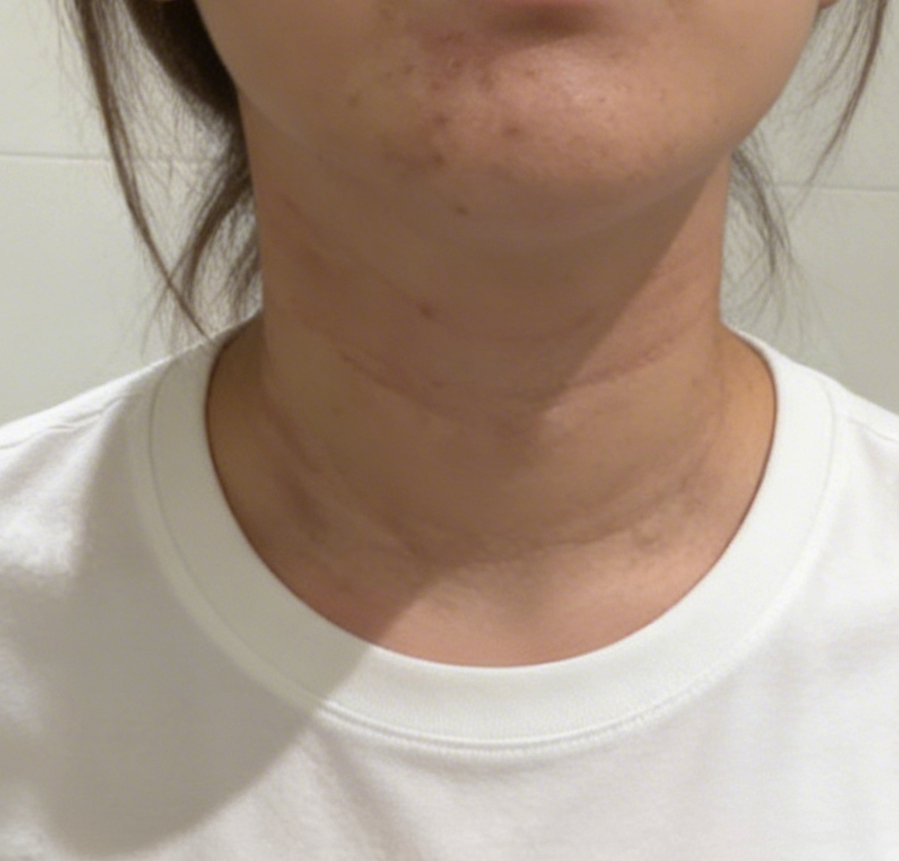 수술후기이미지