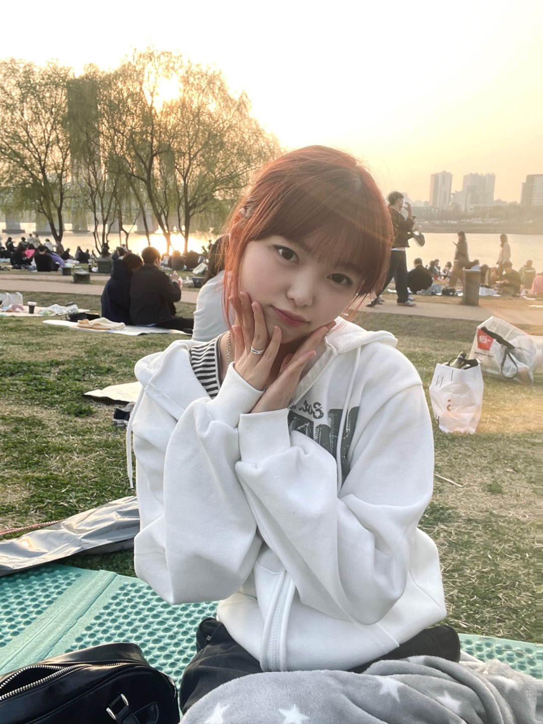 수술후기이미지