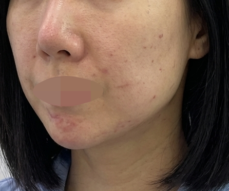 수술후기이미지