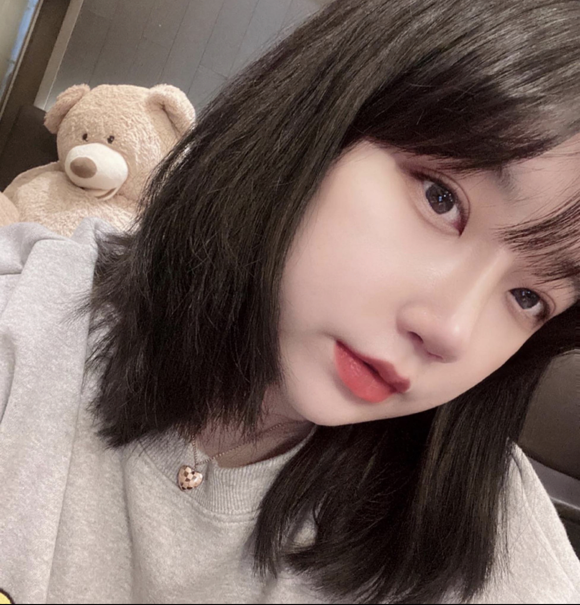 수술후기이미지