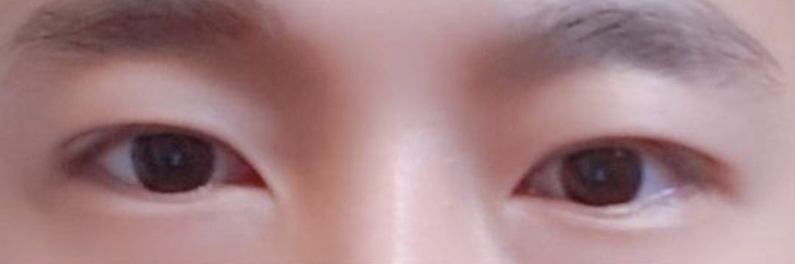 수술후기이미지