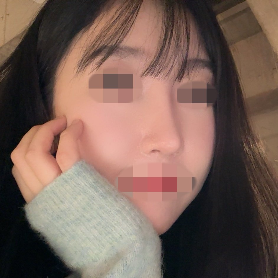 수술후기이미지