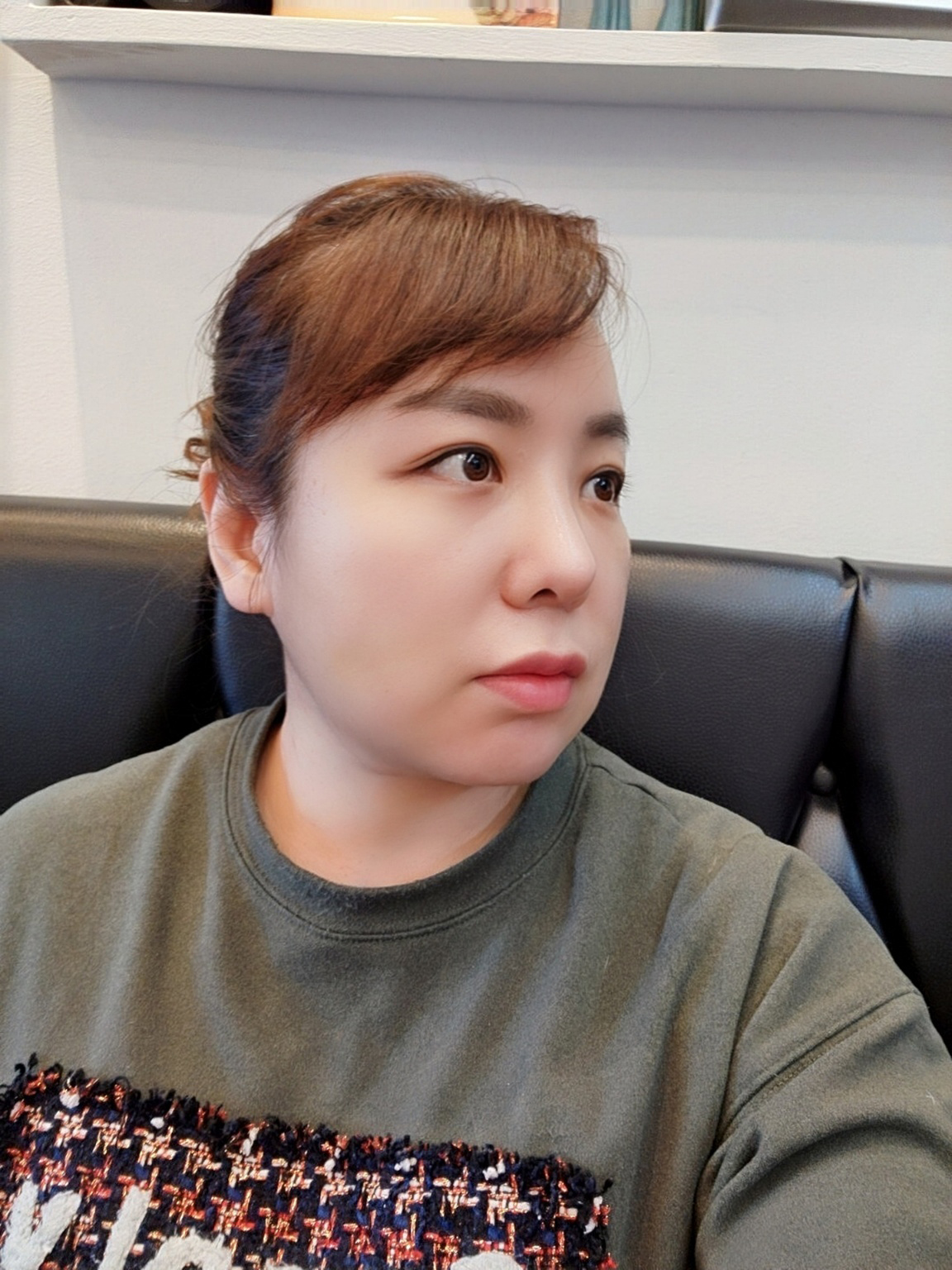 수술후기이미지