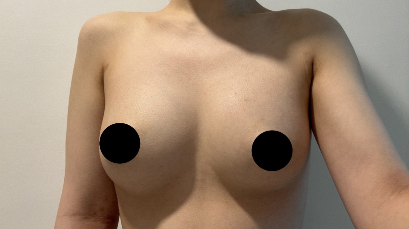 수술후기이미지