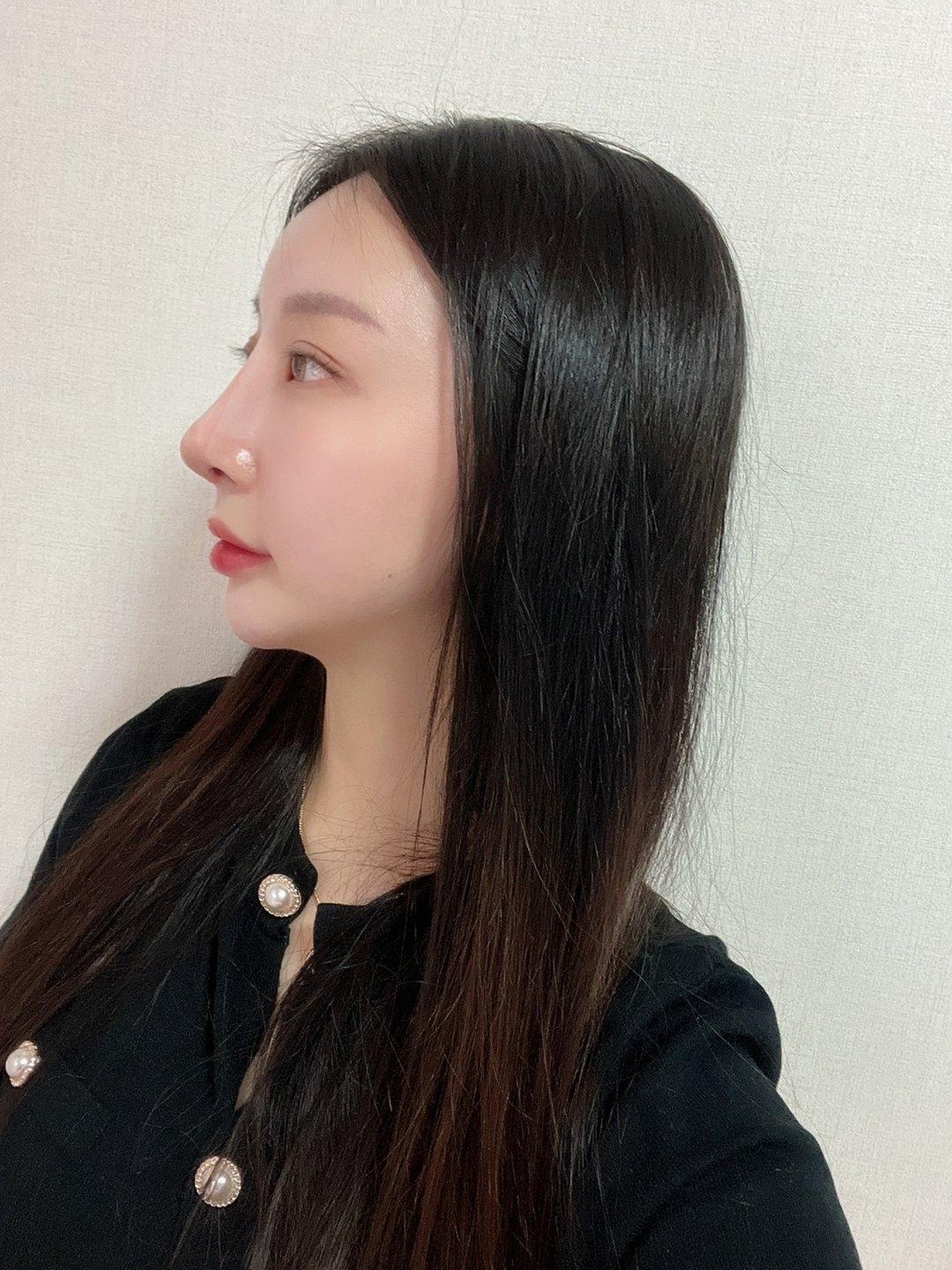 수술후기이미지