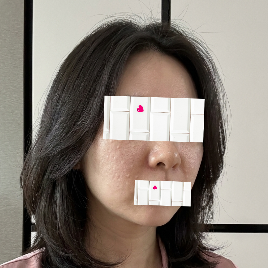 수술후기이미지