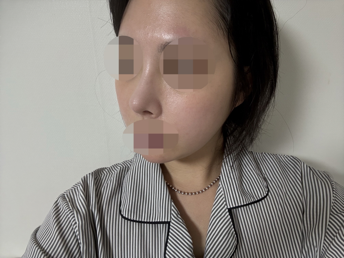 수술후기이미지