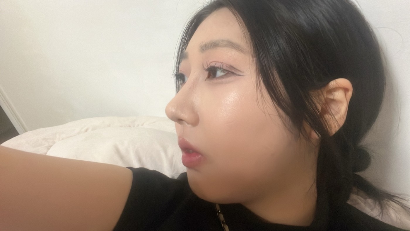 수술후기이미지