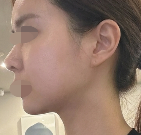 수술후기이미지