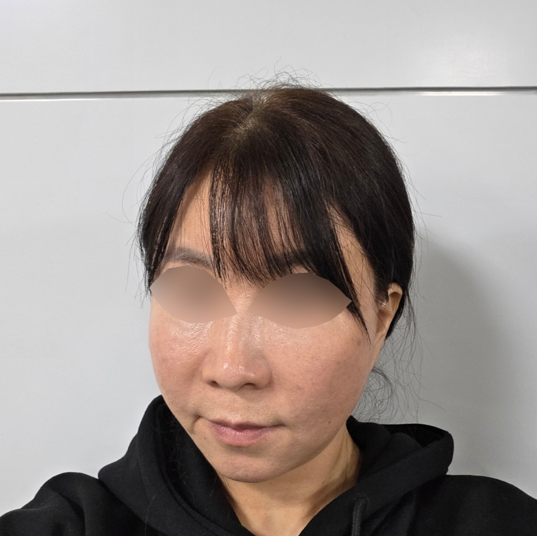 수술후기이미지