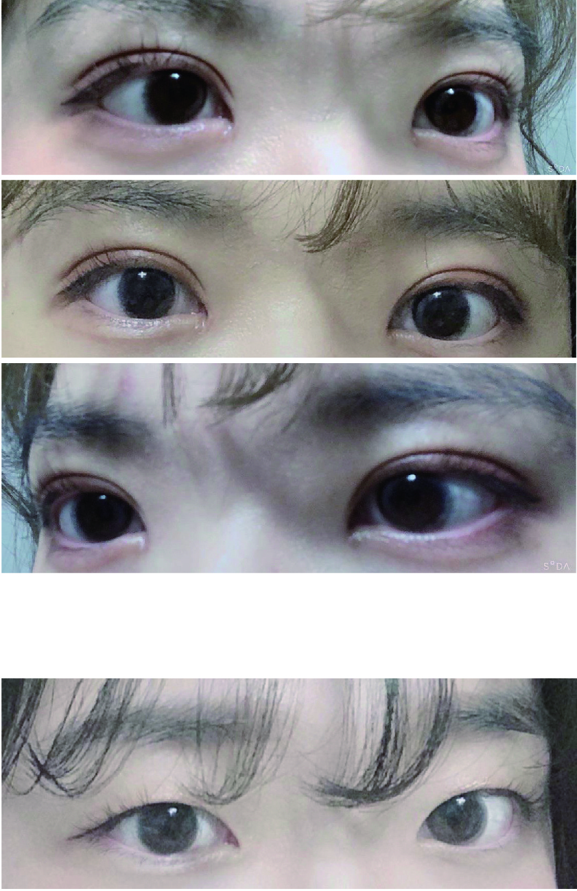 수술후기이미지