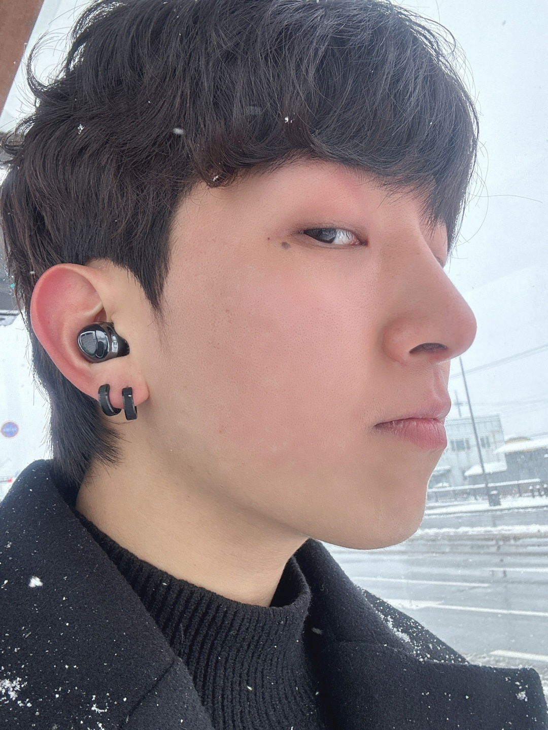 수술후기이미지