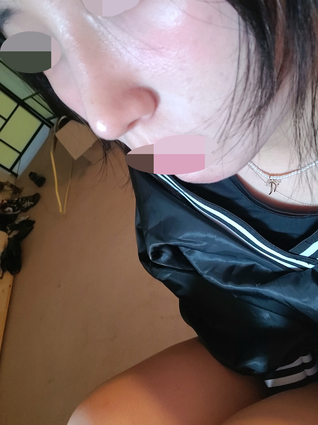 수술후기이미지