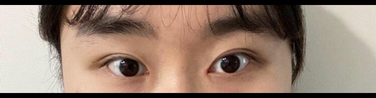 수술후기이미지