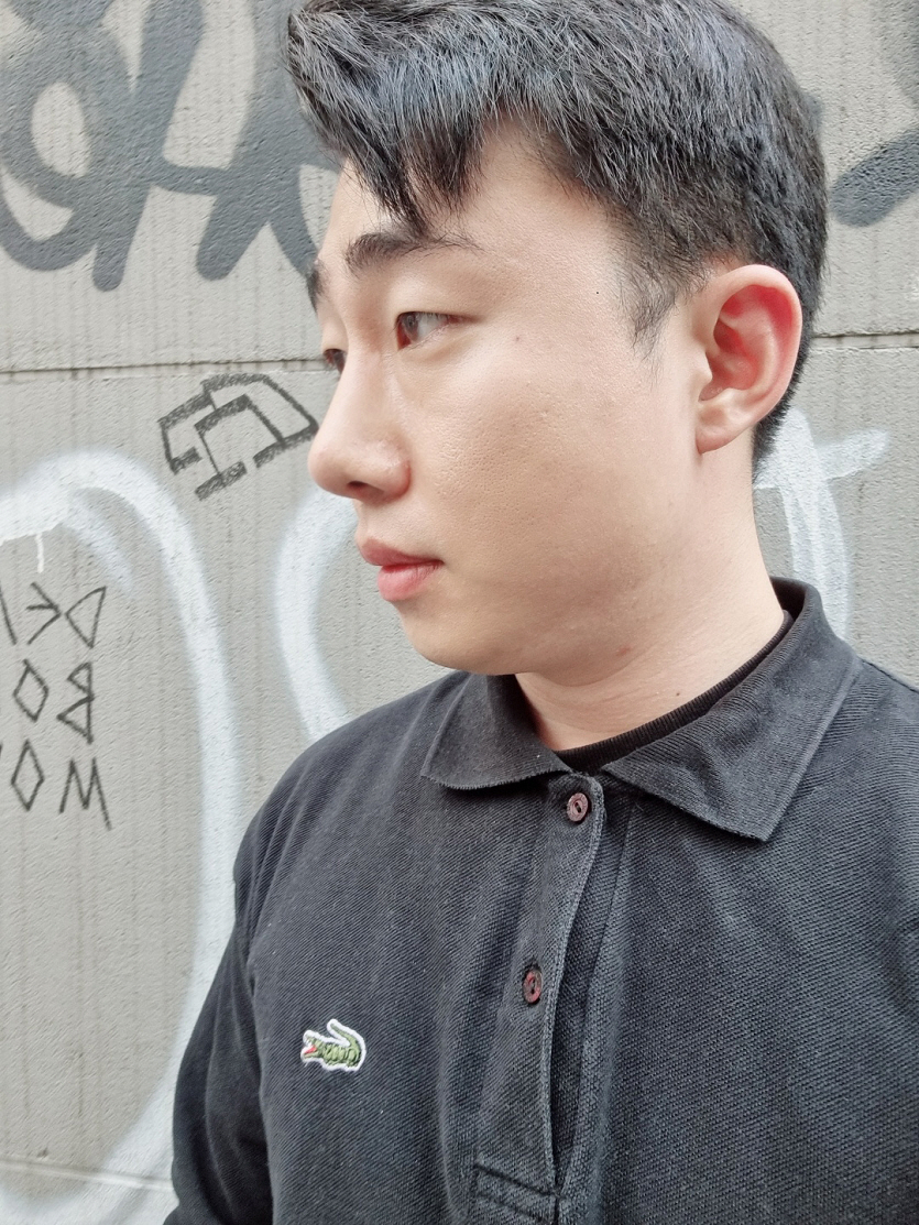 수술후기이미지