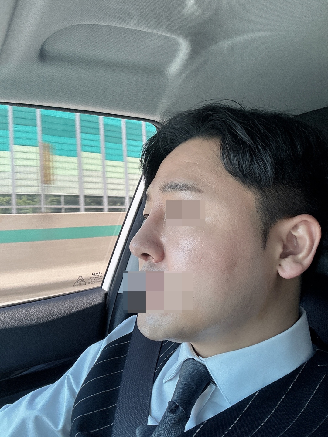 수술후기이미지