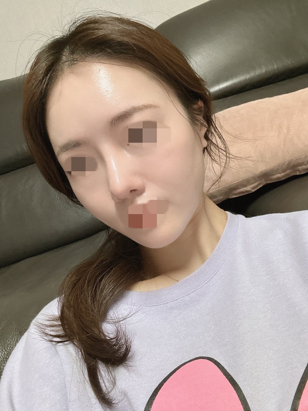 수술후기이미지