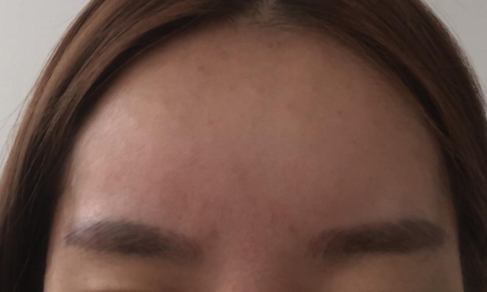 수술후기이미지