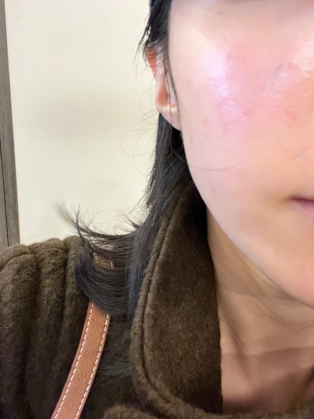 수술후기이미지