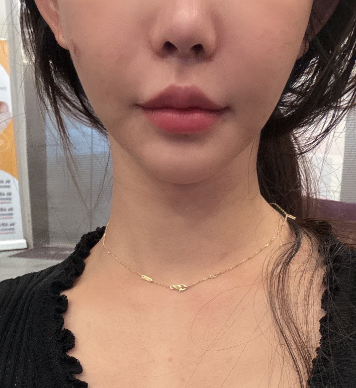 수술후기이미지