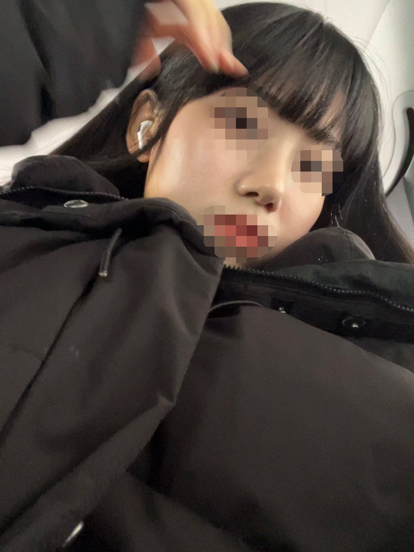 수술후기이미지