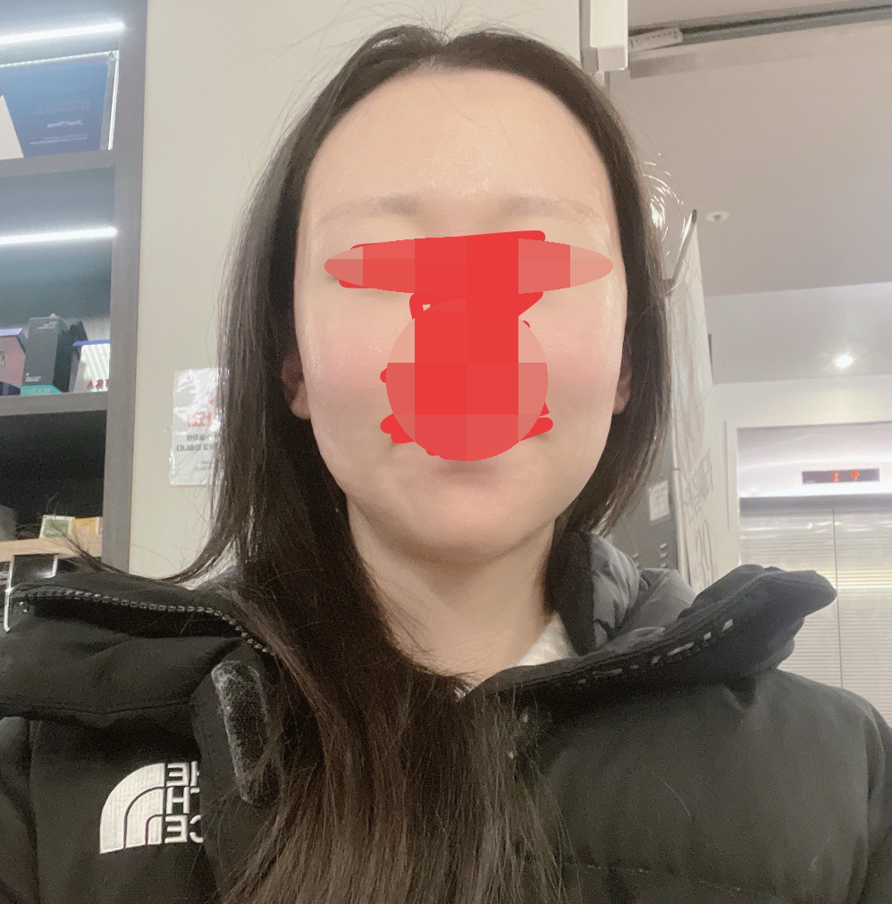 수술후기이미지