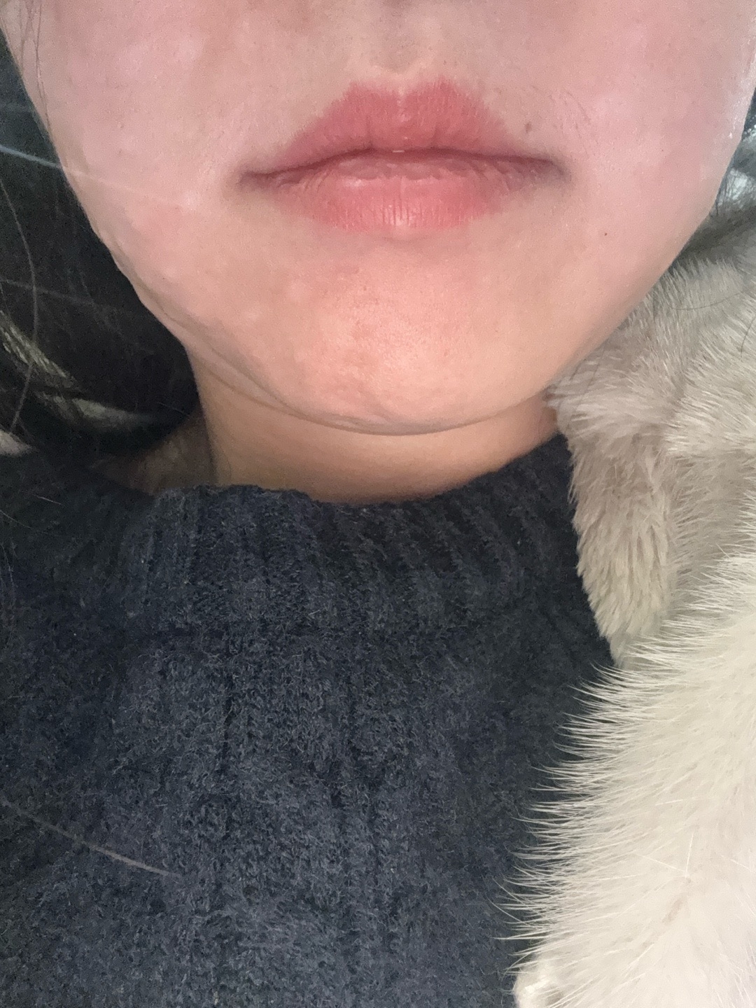 수술후기이미지