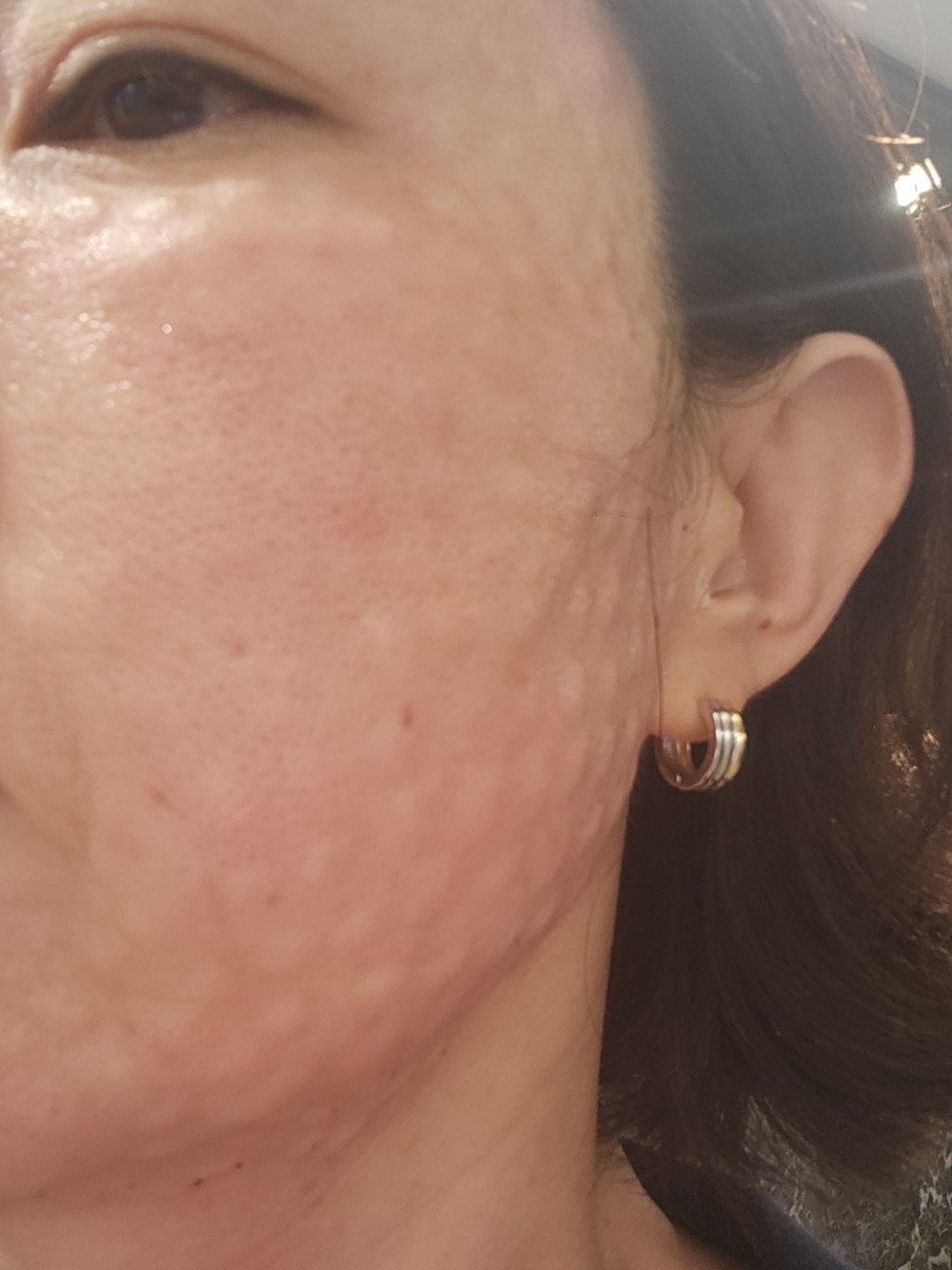 수술후기이미지