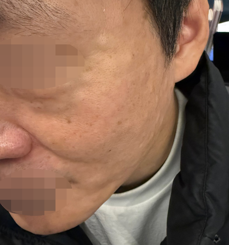 수술후기이미지