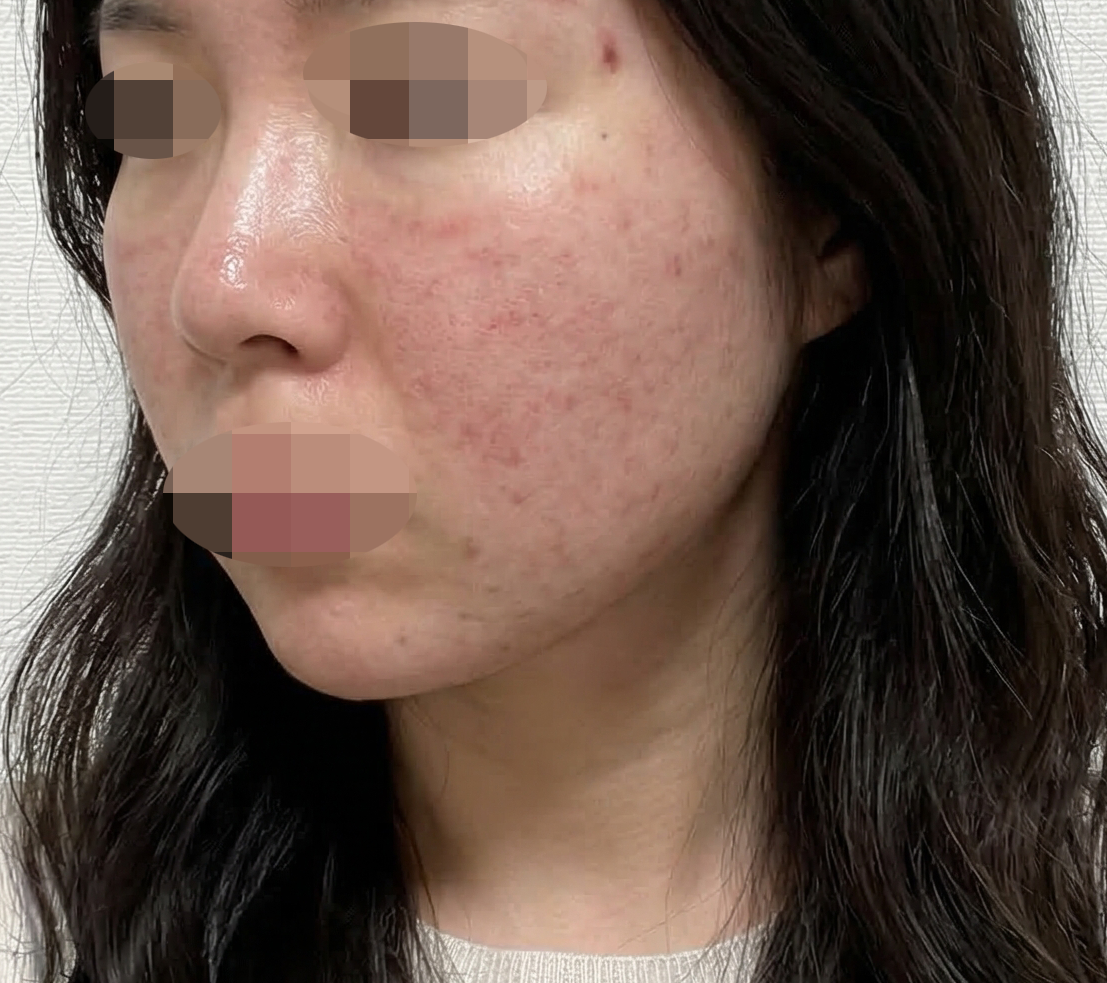 수술후기이미지