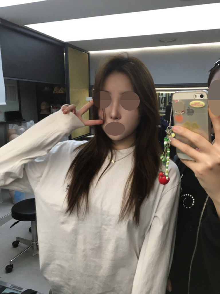 수술후기이미지