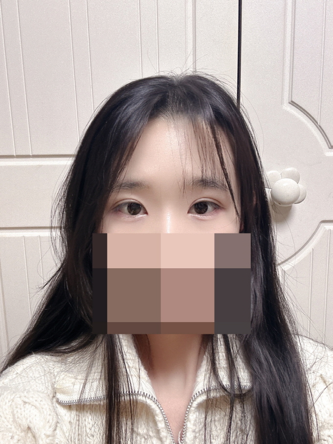 수술후기이미지