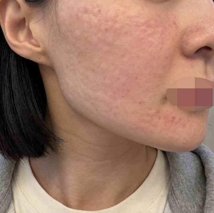 수술후기이미지