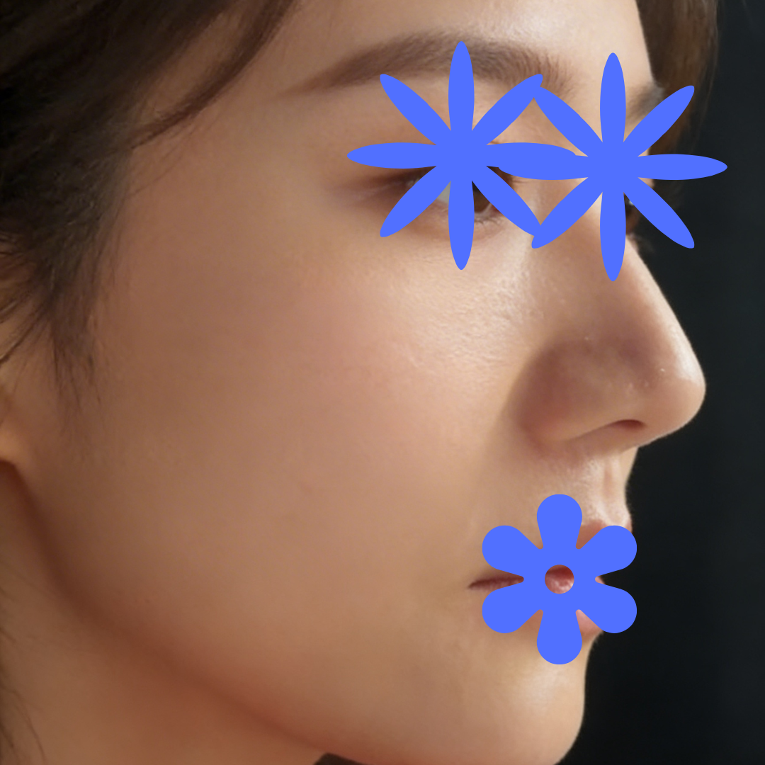 수술후기이미지