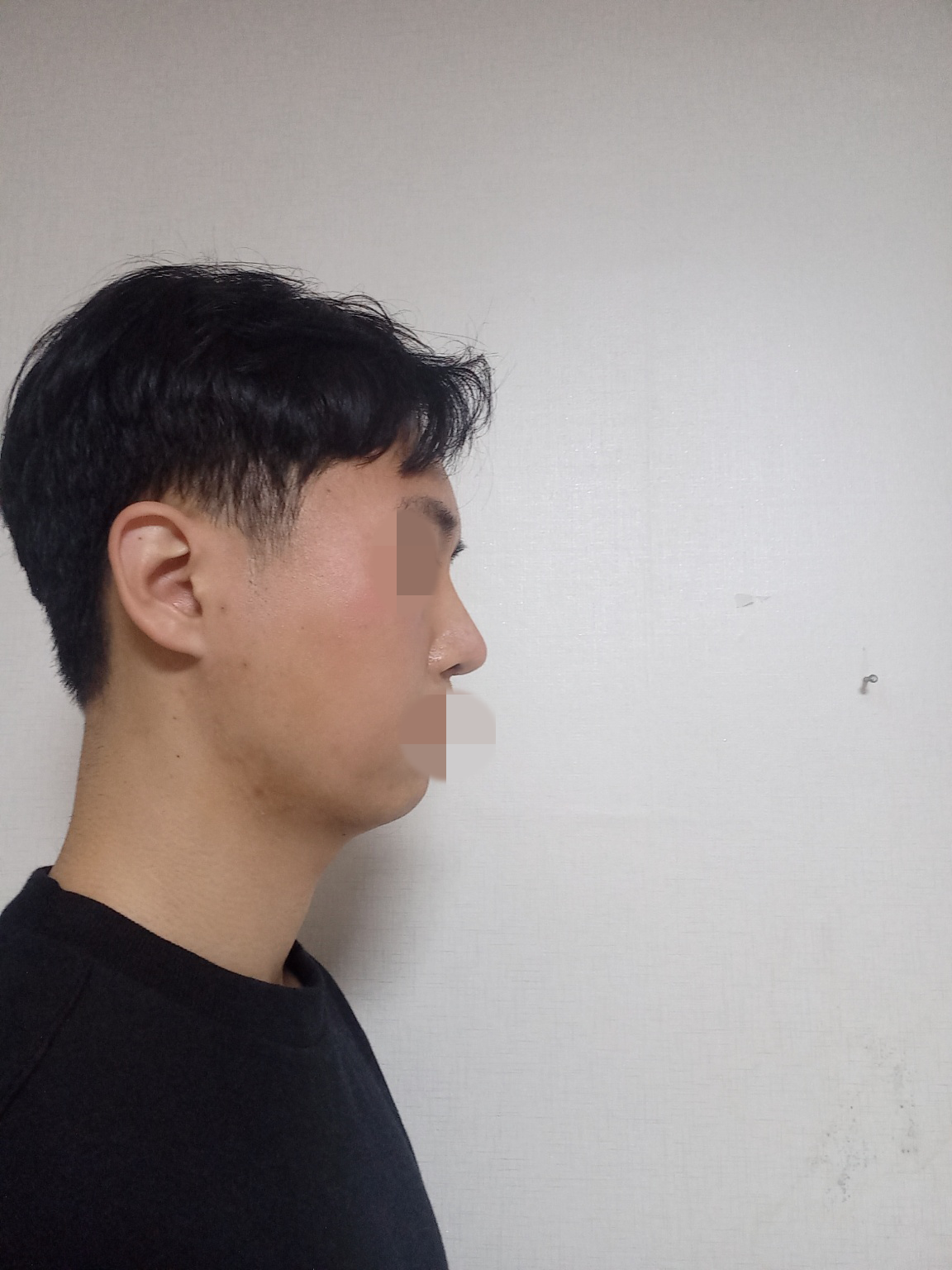 수술후기이미지