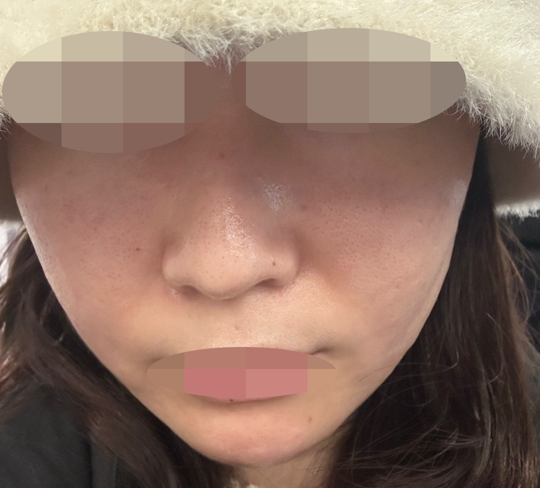 수술후기이미지