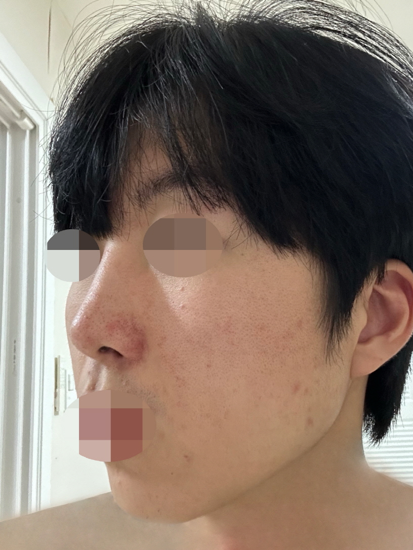 수술후기이미지