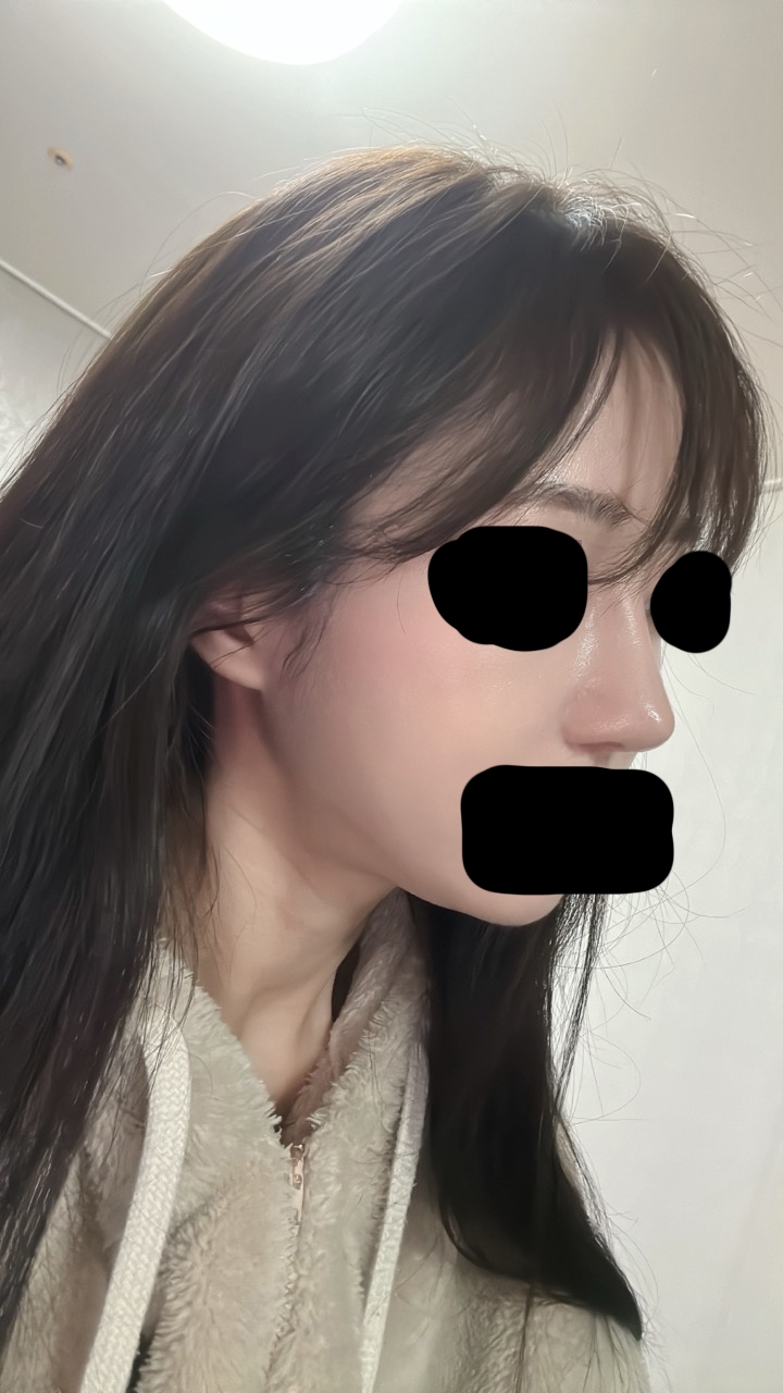 수술후기이미지