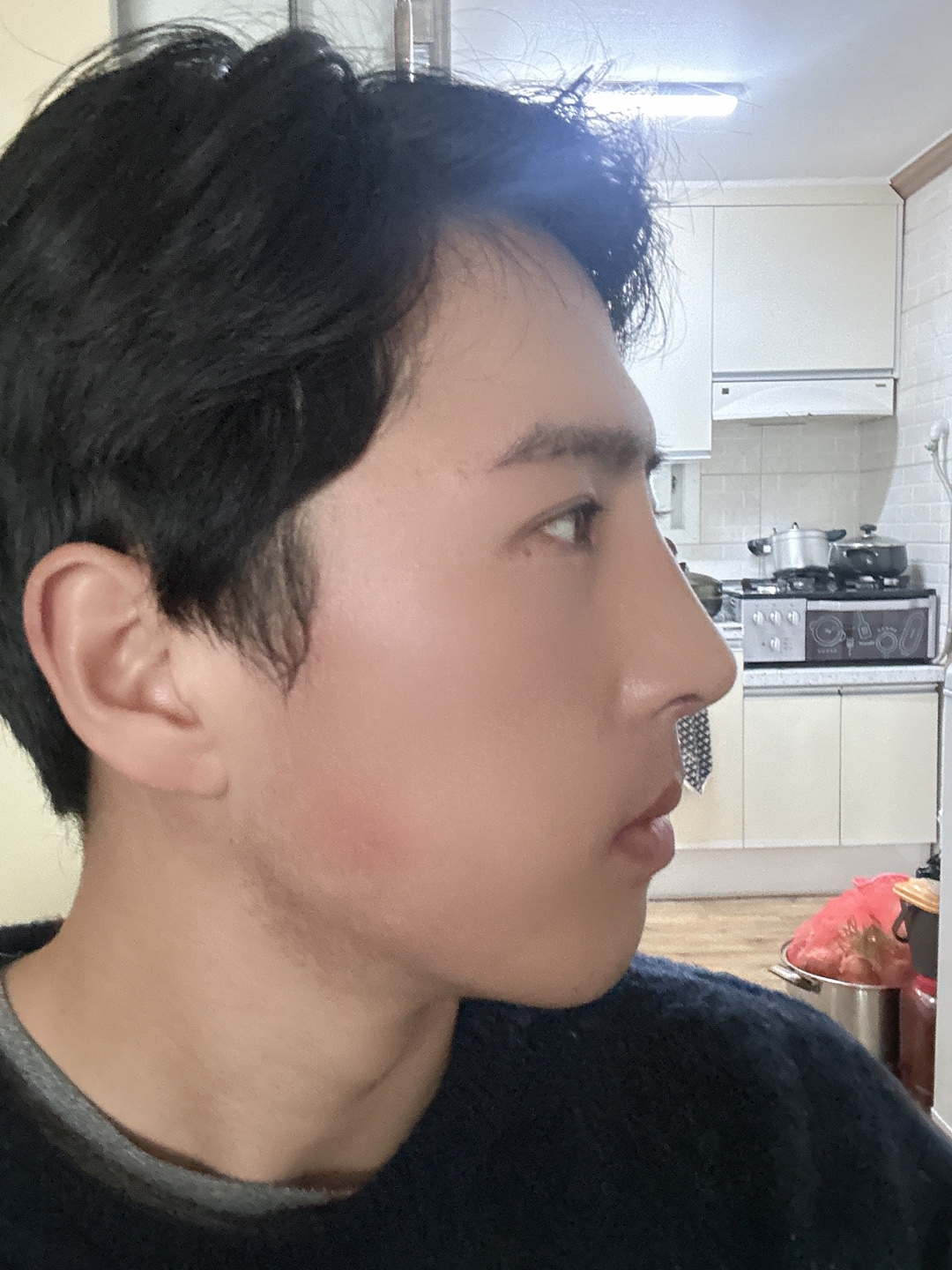 수술후기이미지