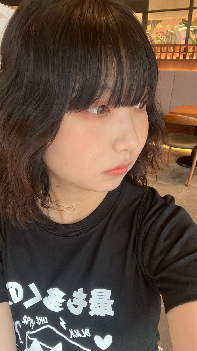 수술후기이미지