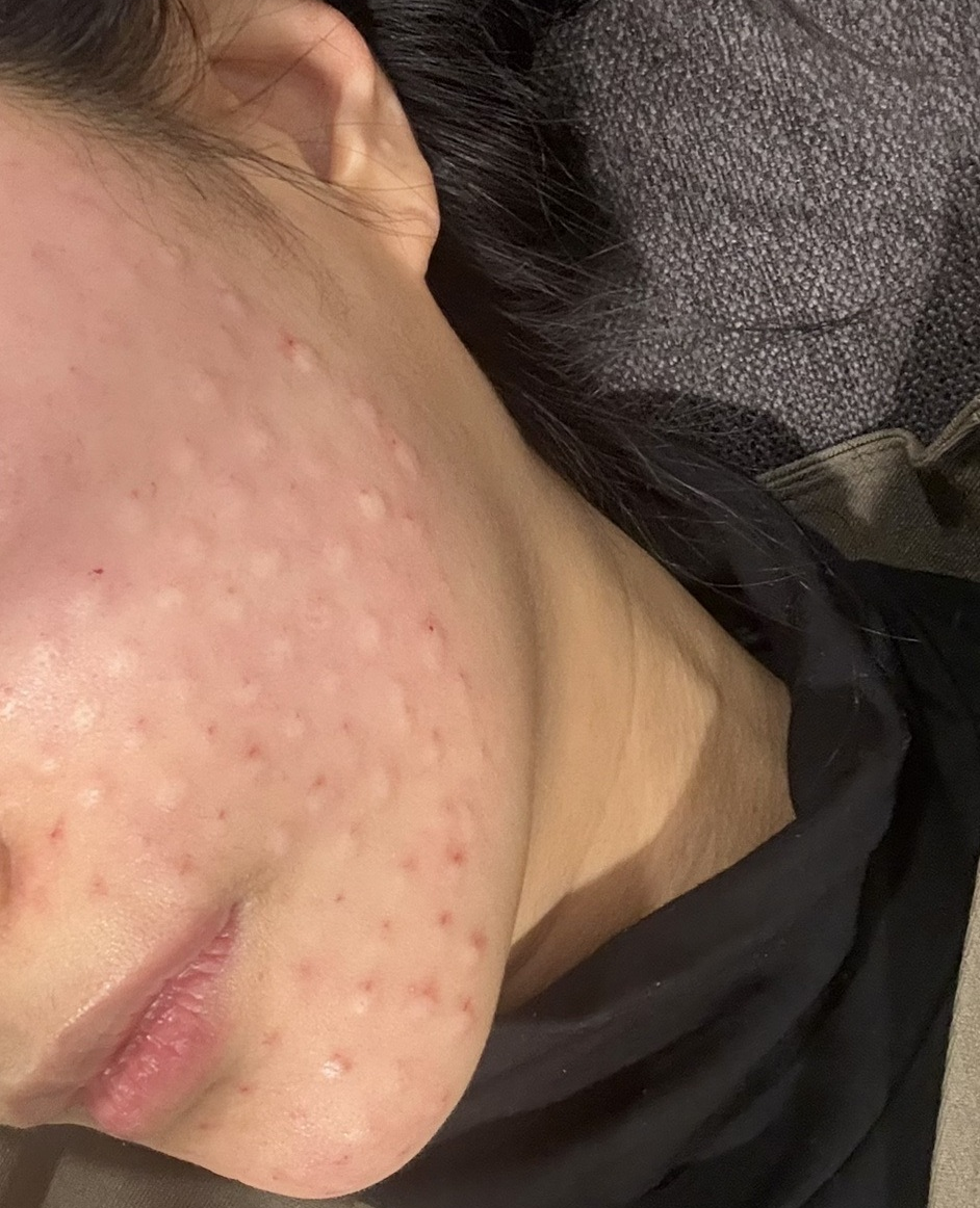 수술후기이미지